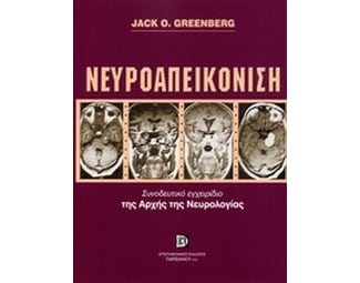 Νευροαπεικόνιση image 0