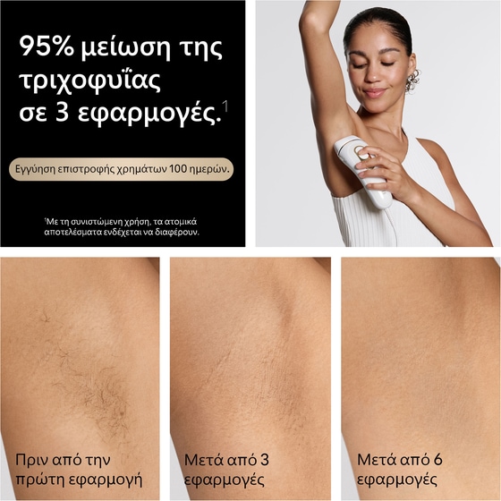 Αποτριχωτική Μηχανή BRAUN SERIES 5 PL5210 IPL Λευκό image 8