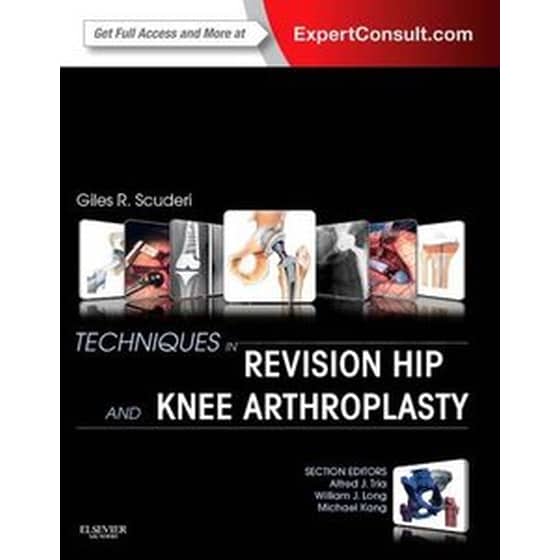 Techniques in Revision Hip and Knee Arthroplasty image 0