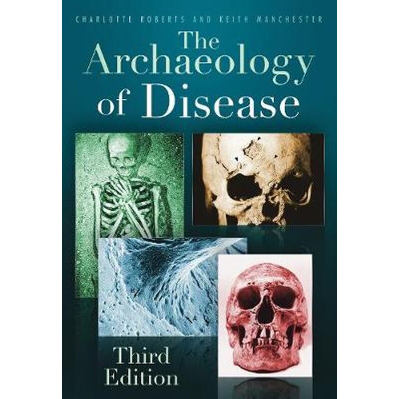 Archaeology of Disease