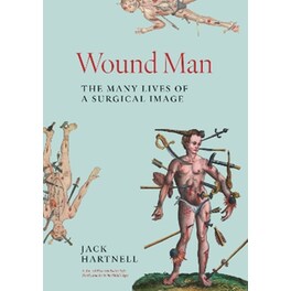 Wound Man