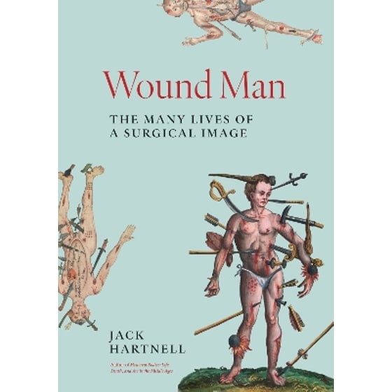 Wound Man image 0