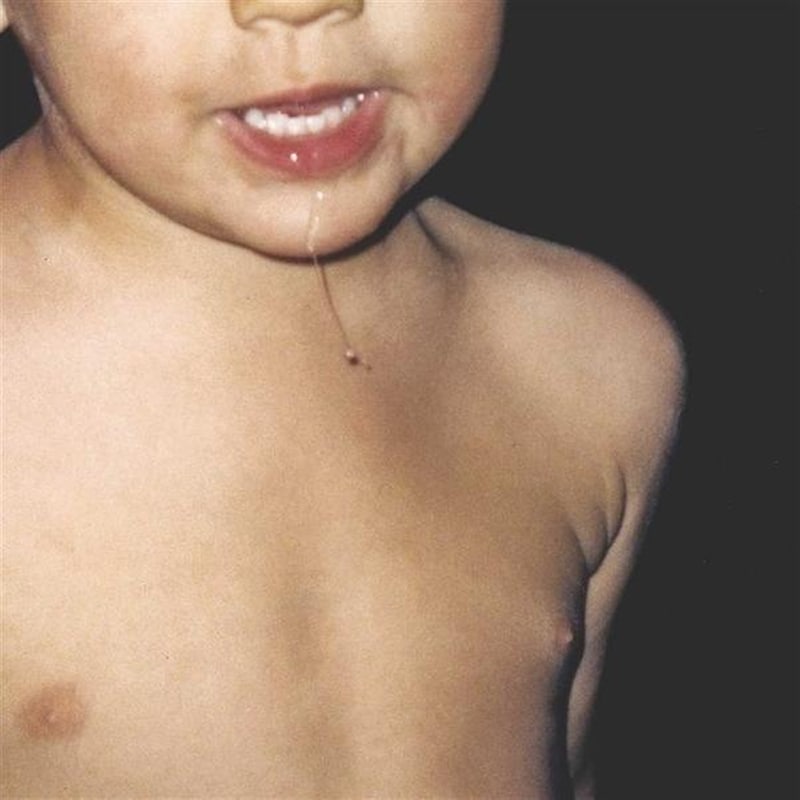 Todavia No (Limited White Vinyl)