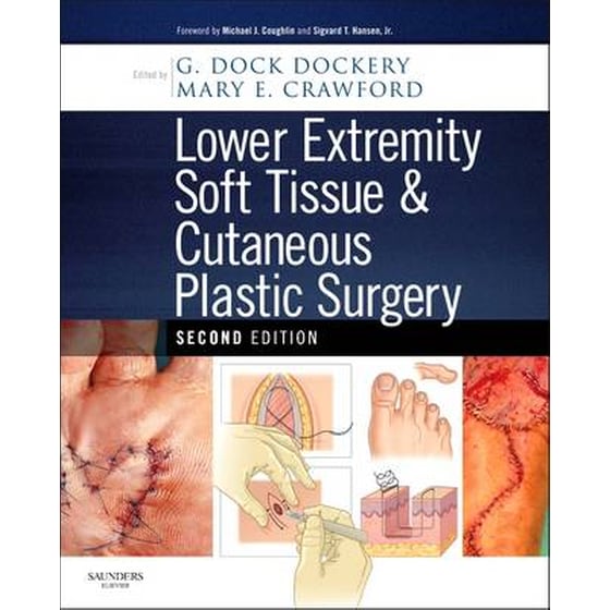 Lower Extremity Soft Tissue & Cutaneous Plastic Surgery image 0