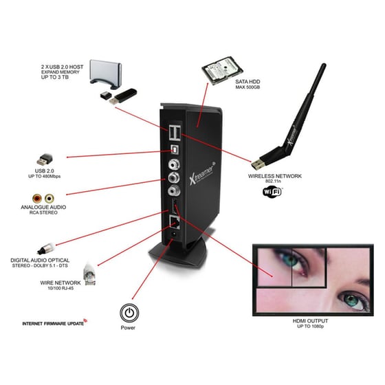 Xtreamer Media Player & Streamer image 3