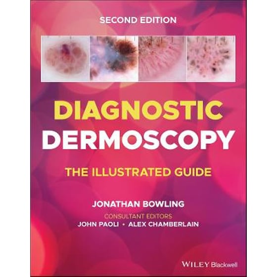 Diagnostic Dermoscopy - The Illustrated Guide, 2e image 0