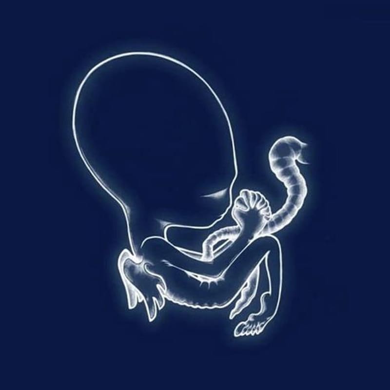 Agaetis Byrjun