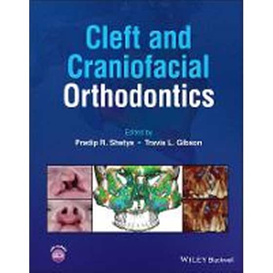 Cleft and Craniofacial Orthodontics image 0