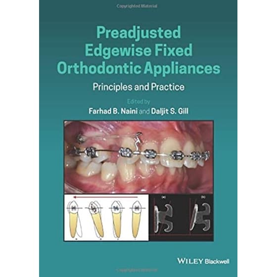 Preadjusted Edgewise Fixed Orthodontic Appliances - Principles and Practice image 0