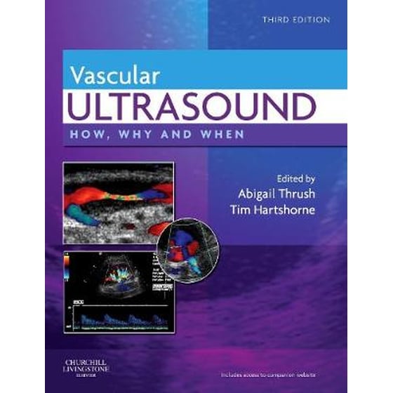 Vascular Ultrasound image 0
