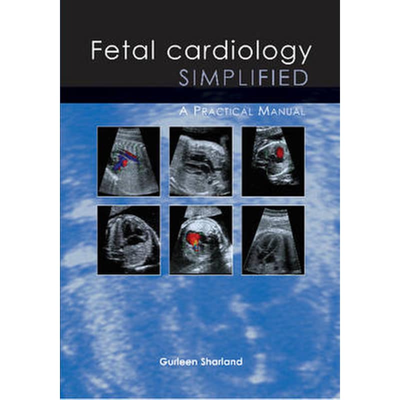 Fetal Cardiology Simplified