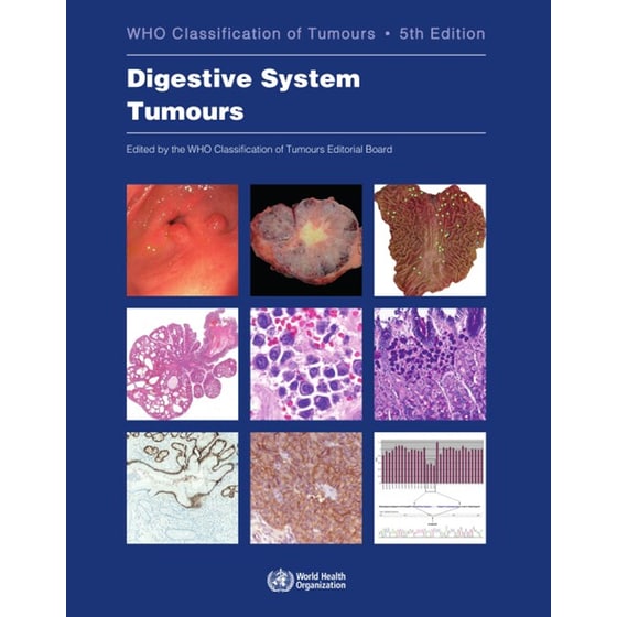 Digestive System Tumours image 0