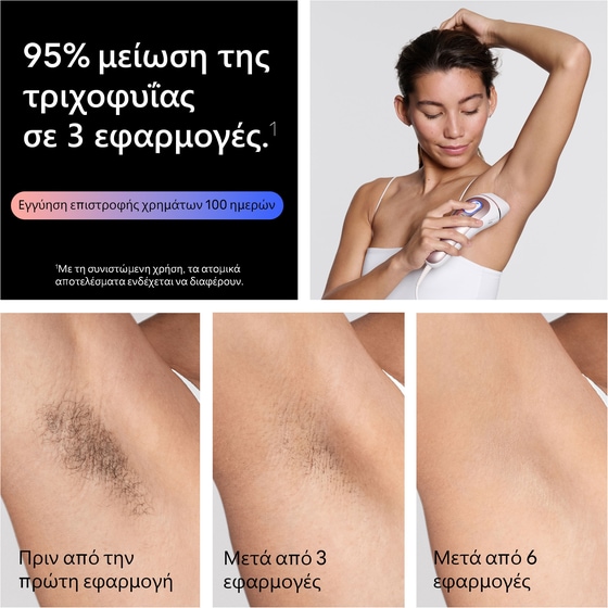 Αποτριχωτική ΜηχανήBRAUN SERIES 7 PL7321 IPL Λευκό-Ροζ image 10