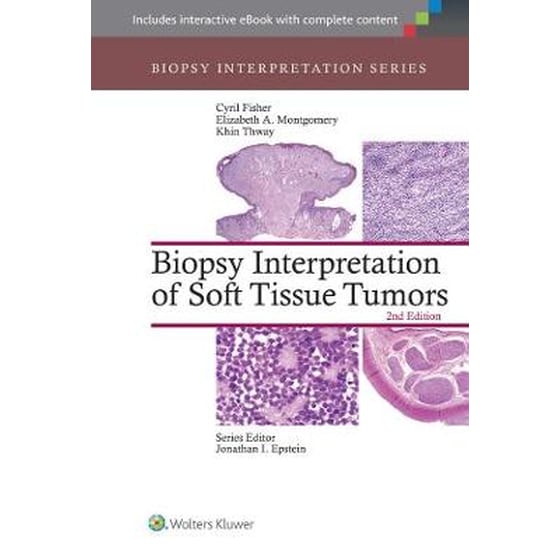 Biopsy Interpretation of Soft Tissue Tumors image 0