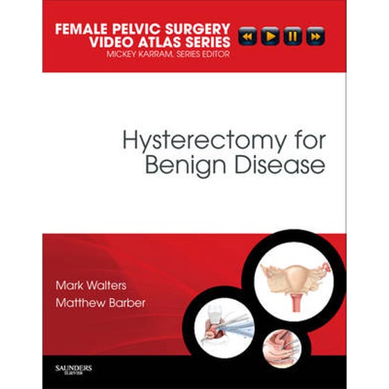 Hysterectomy for Benign Disease image 0