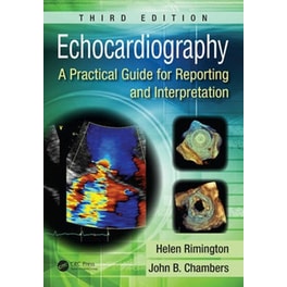 Echocardiography
