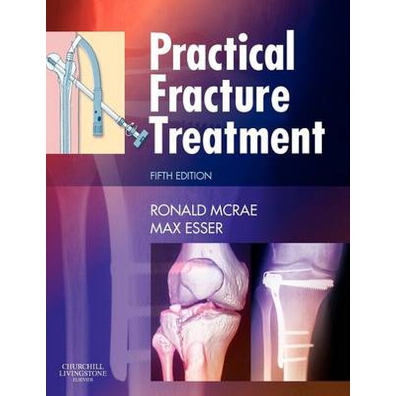 Practical Fracture Treatment