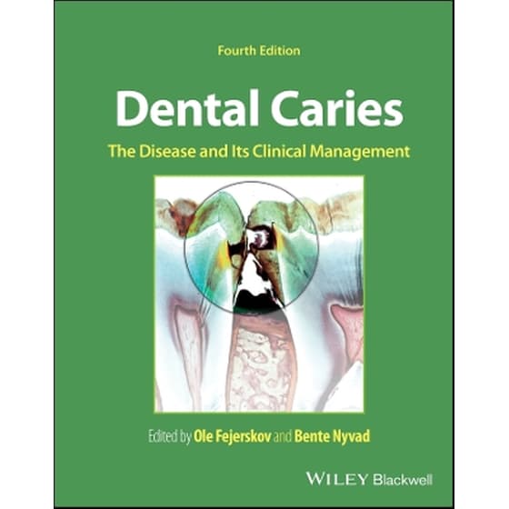 Dental Caries image 0