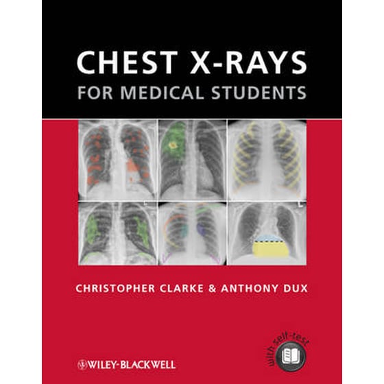 Chest X-rays for Medical Students image 0