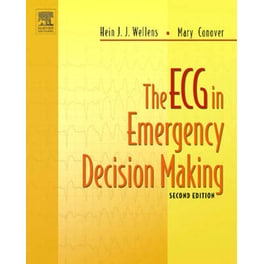 ECG in Emergency Decision Making