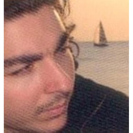 Αστεγοσκόπιο image 1