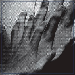 Surveillance (LP)